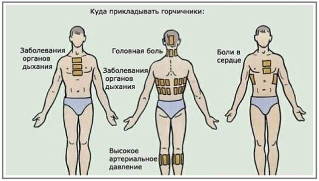 Горчичники при кашле для взрослых и детей